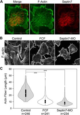 Coordinated regulation of Cdc42ep1, actin, and septin filaments during neural crest cell migration